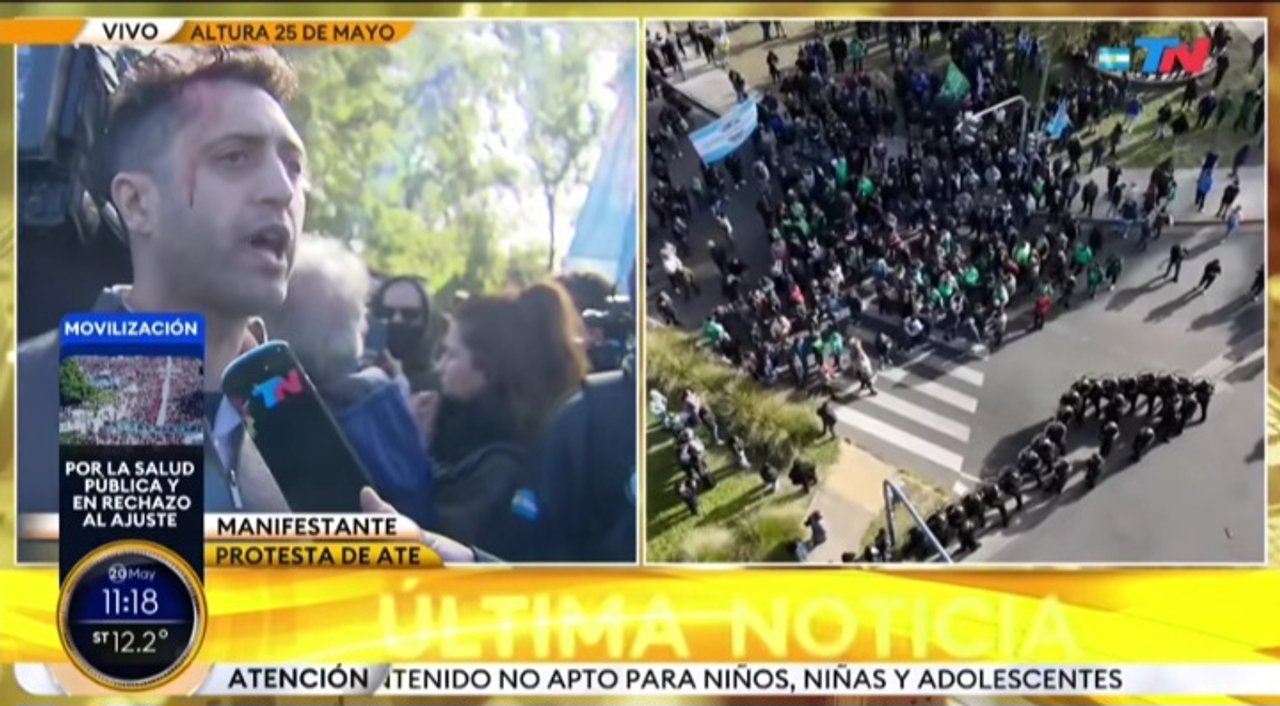 Imagen para el artículo: La fuerte reacción de Lorena Maciel por el entrevistado que perdía sangre en vivo tras la represión