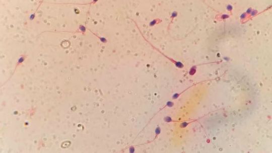 Imagen para el artículo: HyperSperm, la innovación argentina que mejora la fertilización in vitro y abre una nueva esperanza para miles de parejas
