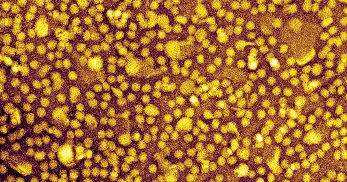 Imagen para el artículo: ¿Una sola inyección para controlar el colesterol de por vida? Un estudio señala que podría ser posible