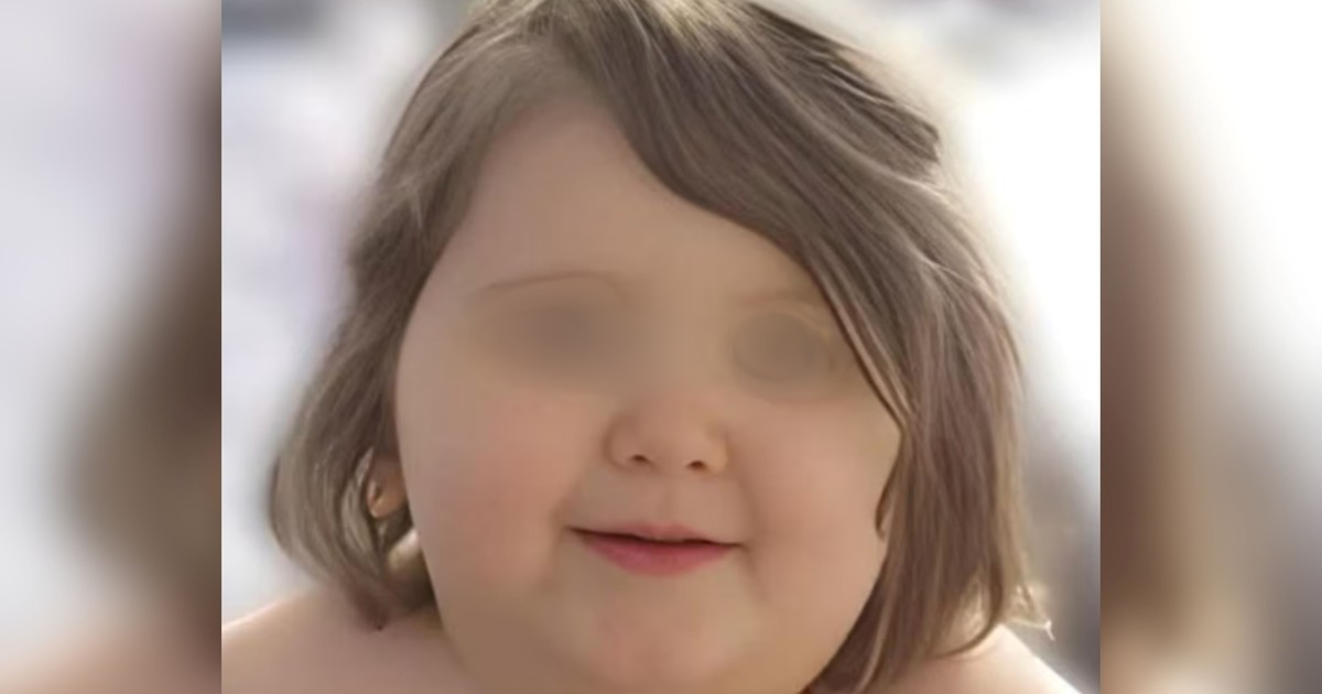 Imagen para el artículo: Un niño de 7 años murió tras alcanzar los 116 kilos: "Fue un caso triste y horrible de negligencia deliberada por parte de los padres"